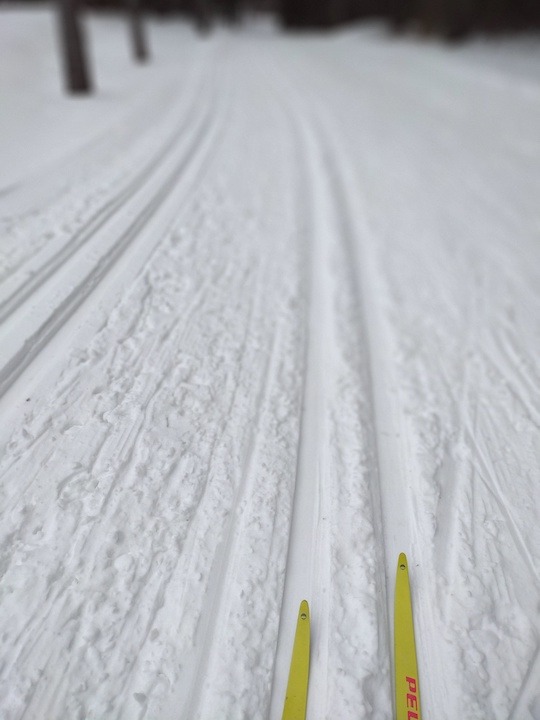 yellow ski tips on a groomed cross country ski trail